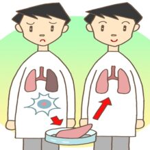 DDSの基礎とハイドロゲルの活用《2日目：ハイドロゲルを用いたDDS研究例》【提携セミナー】